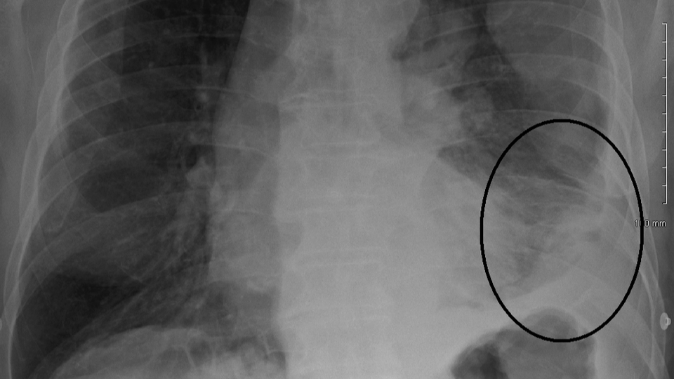 GUEST VIEW: ‘Shadow registry of exposure’ must be replaced by national registries and accountability in Kentucky